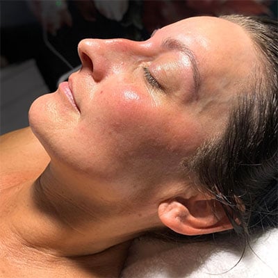 SKIN CARE